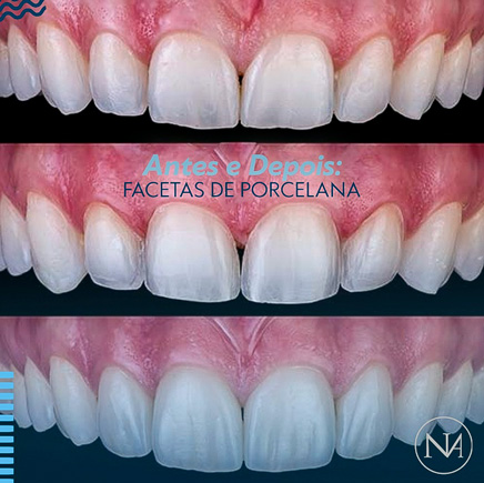 ANTES-E-DEPOIS-03