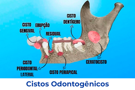CIRURGIA-001
