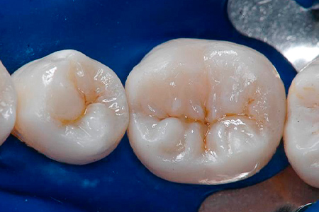 DENTISTICA-001-2