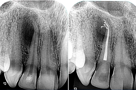 ENDODONTIA-001