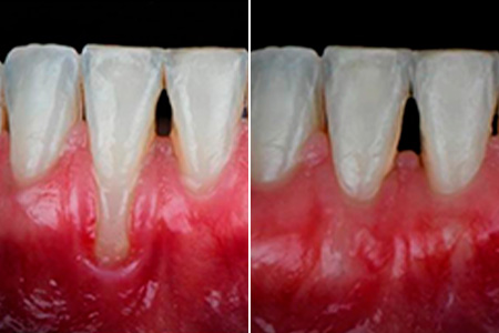PERIODONTIA-003