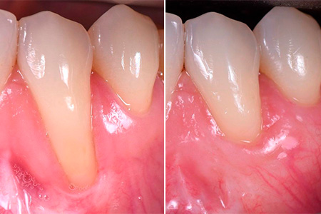 PERIODONTIA-004